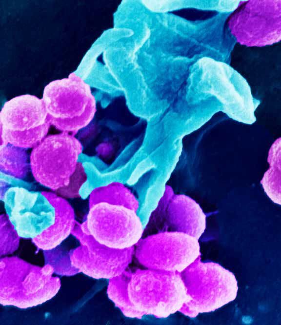 Microscopic Dance: The Symbiosis and Struggle of Bacteria and Host