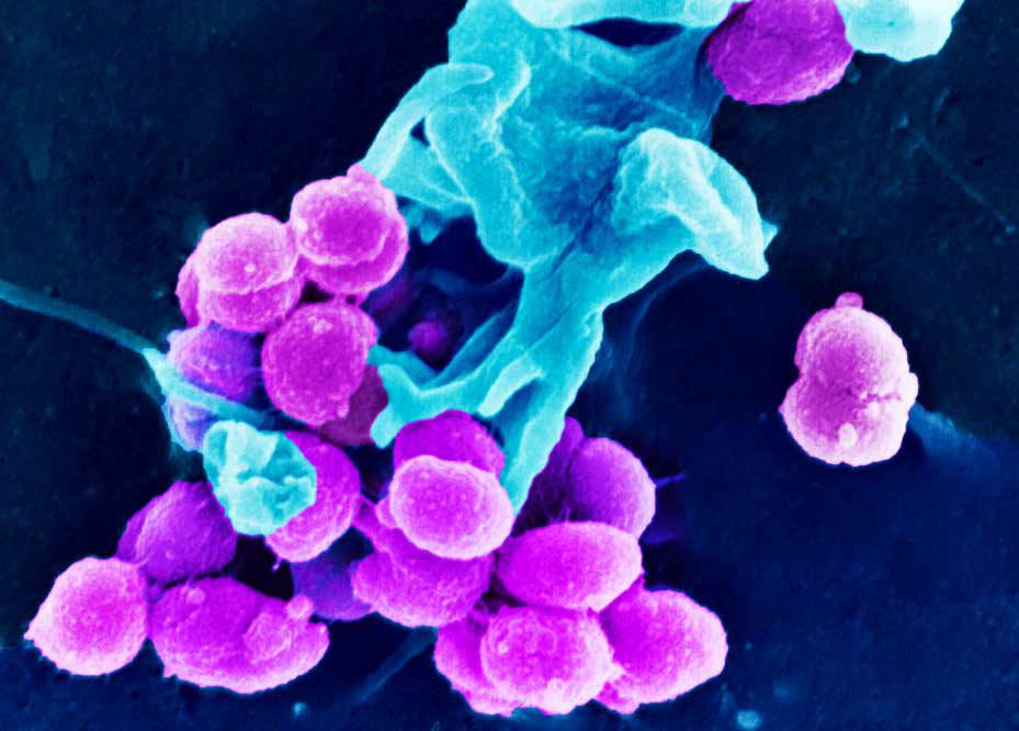 Microscopic Dance: The Symbiosis and Struggle of Bacteria and Host
